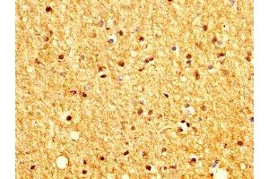 IHC image of ABIN7165907 diluted at 1:200 and staining in paraffin-embedded human brain tissue performed on a Leica BondTM system. (Patched 2 antibody  (AA 793-951))