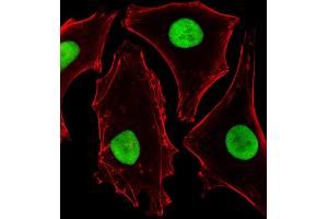 Fluorescent image of Hela cells stained with SUMO2 Antibody (C-term) B. (SUMO2 antibody)