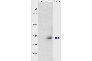 Lane 1: mouse brain lysates Lane 2: mouse heart lysates probed with Anti TUSC3 Polyclonal Antibody, Unconjugated (ABIN762656) at 1:200 in 4 °C.