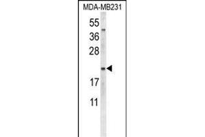 Western blot analysis of NEU1 Antibody (Center) (ABIN653650 and ABIN2842991) in MDA-M cell line lysates (35 μg/lane). (NEU1 antibody  (AA 11-40))