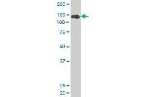 ZFHX1B monoclonal antibody (M02), clone 2H5. (ZEB2 antibody  (AA 1115-1214))