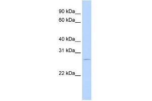 RBM38 antibody used at 0. (RBM38 antibody  (N-Term))