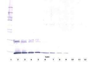 Image no. 2 for anti-Interleukin 5 (IL5) antibody (ABIN465636) (IL-5 antibody)