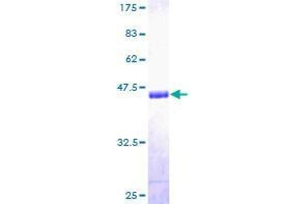 COL20A1 Protein (AA 1-155) (GST tag)