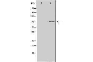 Western blot analysis of K562 whole cell lysates, using NDC80 Antibody. (NDC80 antibody  (C-Term))