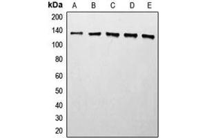 Western blot analysis of Histone Deacetylase 5 expression in MCF7 (A), Jurkat (B), HeLa (C), mouse liver (D), rat liver (E) whole cell lysates.