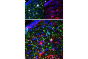 Expression of NTR2 in rat mediobasal hypothalamus - Immunohistochemical staining of perfusion-fixed brain frozen rat mediobasal (MB) hypothalamus sections using Anti-Neurotensin Receptor 2 Antibody (ABIN7043384, ABIN7044769 and ABIN7044770), (1:100), (green). (NTSR2 antibody  (C-Term, Intracellular))