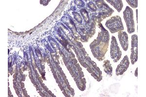IHC analysis of HDAC5 using anti-HDAC5 antibody (ABIN6719321). (HDAC5 antibody  (AA 102-197))