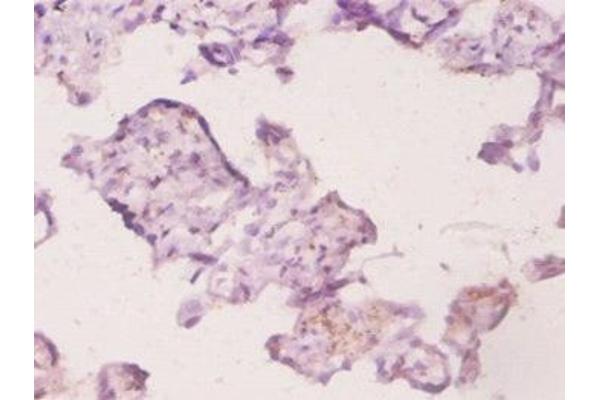 UBE2K antibody  (AA 2-200)