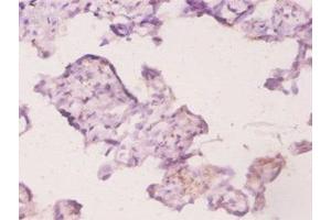 Immunohistochemistry of paraffin-embedded human placenta tissue using ABIN7174460 at dilution of 1:20 (UBE2K antibody  (AA 2-200))