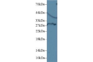 DIO3 anticorps  (AA 37-169)