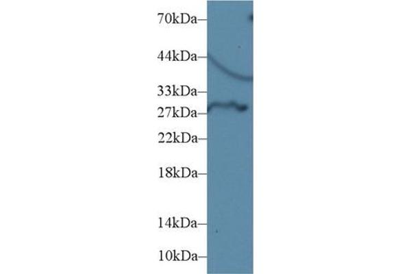 DIO3 anticorps  (AA 37-169)