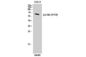 Western Blotting (WB) image for anti-Proto-oncogene tyrosine-protein kinase Src (Src) (pTyr419) antibody (ABIN3179423) (Src antibody  (pTyr419))