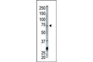 The anti-ST Pab (ABIN1882134 and ABIN2839215) is used in Western blot to detect ST in mouse cerebellum tissue lysate.