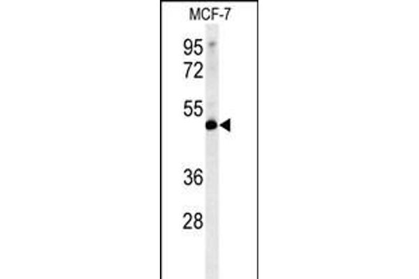 LSP1 Antikörper  (AA 108-134)