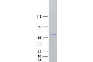 Western Blotting (WB) image for ADP-Ribosylation Factor GTPase Activating Protein 1 (ARFGAP1) (Transcript Variant 1) protein (Myc-DYKDDDDK Tag) (ABIN2714862)
