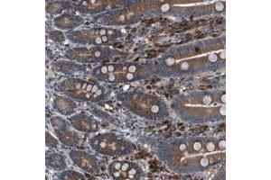 Immunohistochemical staining of human duodenum with EDARADD polyclonal antibody  shows distinct positivity in glandular cells at 1:50-1:200 dilution.