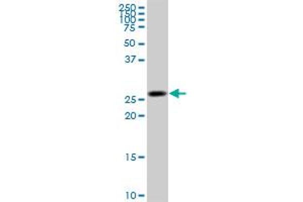 Ketohexokinase antibody  (AA 1-298)