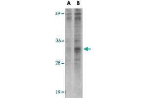 Western blot analysis of METTL7B in Jurkat cell lysate with METTL7B polyclonal antibody  at (A) 2 and (B) 4 ug/mL .