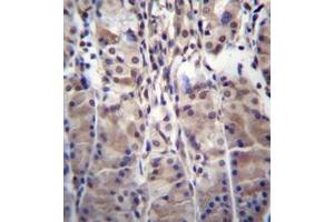 Immunohistochemistry analysis in formalin fixed and paraffin embedded human stomach tissue reacted with MDM1 Antibody (C-term) followed which was peroxidase conjugated to the secondary antibody and followed by DAB staining. (MDM1 antibody  (C-Term))