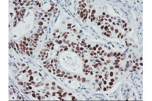 Image no. 9 for anti-Tumor Protein P53 (TP53) antibody (ABIN1499967) (p53 antibody)