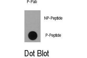 Image no. 1 for anti-Ribosomal Protein S6 Kinase, 90kDa, Polypeptide 1 (RPS6KA1) (pSer363) antibody (ABIN358393)