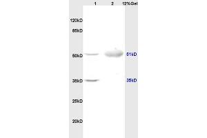 Lane 1: rat brain lysates Lane 2: human colon carcinoma lysates probed with Anti OLFM1/Noelin Polyclonal Antibody, Unconjugated (ABIN678308) at 1:200 in 4 °C. (Olfactomedin 1 antibody  (AA 101-200))