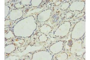 Immunohistochemistry of paraffin-embedded human thyroid tissue using ABIN7175073 at dilution of 1:100