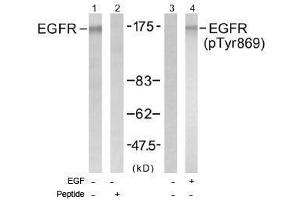 Image no. 1 for anti-Epidermal Growth Factor Receptor (EGFR) (pTyr869) antibody (ABIN196976) (EGFR antibody  (pTyr869))