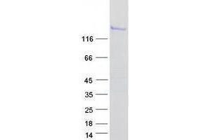 ZBTB10 Protein (Transcript Variant 2) (Myc-DYKDDDDK Tag)