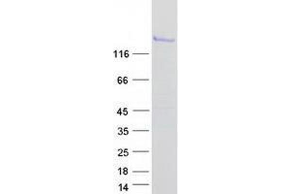 ZBTB10 Protein (Transcript Variant 2) (Myc-DYKDDDDK Tag)