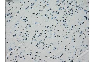 Image no. 5 for anti-Crystallin, alpha B (CRYAB) antibody (ABIN1497641) (CRYAB antibody)