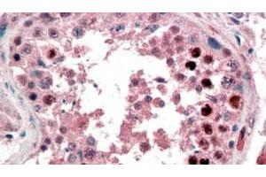 NANOG polyclonal antibody  (2 ug/mL) staining of paraffin embedded human testis. (Nanog antibody  (C-Term))