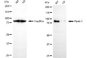 Western blotting analysis using epsin 1 antibody (ABIN7798487). (Recombinant Epsin 1 antibody)