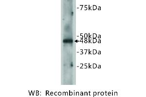 Image no. 2 for anti-Cadherin EGF LAG Seven Pass G-Type Receptor 2 (CELSR2) antibody (ABIN1112870) (CELSR2 antibody)