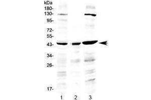 Western blot testing of human 1) HeLa, 2) placenta and 3) A549 lysate with PREB antibody at 0.
