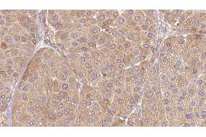 ABIN6277133 at 1/100 staining Human Melanoma tissue by IHC-P. (ELSPBP1 antibody  (C-Term))