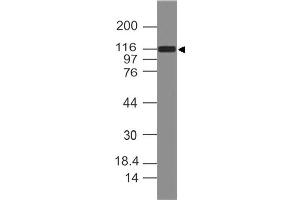 Image no. 1 for anti-Dishevelled Associated Activator of Morphogenesis 1 (DAAM1) (AA 1-230) antibody (ABIN5027643) (DAAM1 antibody  (AA 1-230))