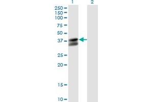 Western Blot analysis of PDHB expression in transfected 293T cell line by PDHB monoclonal antibody (M03), clone 2B2. (PDHB antibody  (AA 250-359))