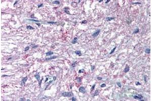 Immunohistochemical (Formalin/PFA-fixed paraffin-embedded sections) staining in human pituitary with GPR50 polyclonal antibody . (GPR50 antibody  (C-Term))