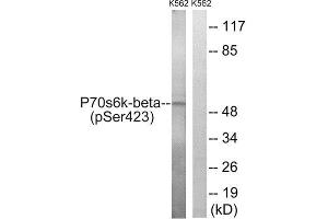 Western Blotting (WB) image for anti-Ribosomal Protein S6 Kinase, 70kDa, Polypeptide 2 (RPS6KB2) (pSer423) antibody (ABIN1847635) (RPS6KB2 antibody  (pSer423))