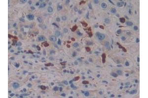 Immunohistochemistry (IHC) image for anti-Linker For Activation of T Cells Family, Member 2 (LAT2) (AA 30-209) antibody (ABIN7439774)