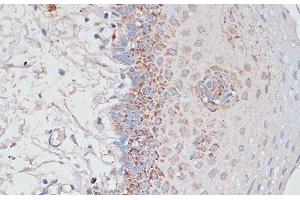 Immunohistochemistry (Paraffin-embedded Sections) (IHC (p)) image for anti-Desmoplakin (DSP) antibody (ABIN7263625)