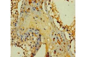 Immunohistochemistry of paraffin-embedded human testis tissue using ABIN7166618 at dilution of 1:100 (PRY antibody  (AA 13-147))