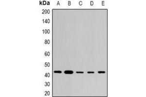 Western blot analysis of STX expression in THP1 (A), SKOV3 (B), mouse brain (C), mouse lung (D), rat heart (E) whole cell lysates. (ST8SIA2 antibody)