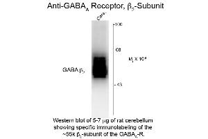 Western Blotting (WB) image for anti-gamma-aminobutyric Acid (GABA) A Receptor, beta 2 (GABRB2) (Cytoplasmic Loop) antibody (ABIN6658224)