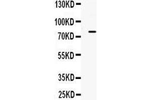 Observed bind size: 80KD (ADRBK2 antibody  (C-Term))