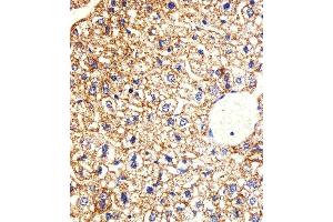 Immunohistochemical analysis of paraffin-embedded M. (CSNK1G3 antibody  (C-Term))