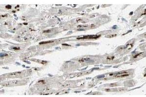 Affinity Purified anti-iASPP antibody shows strong cytoplasmic and membranous staining of myocytes in human heart tissue. (PPP1R13L antibody  (Isoform 1))