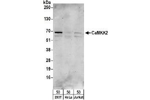 Western Blotting (WB) image for anti-Calcium/calmodulin-Dependent Protein Kinase Kinase 2, beta (CAMKK2) (AA 538-588) antibody (ABIN7455000)
